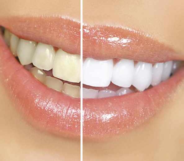 teeth
