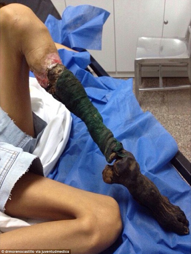 snake venom effect