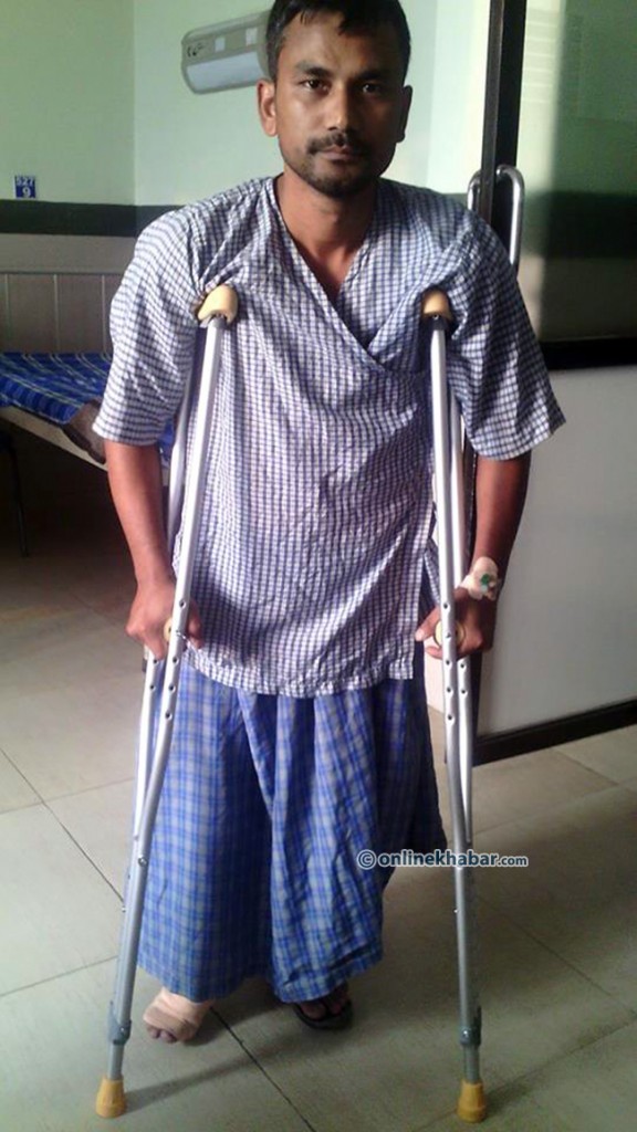 after-surgery-poliyo-cyclset-chitra-poudel