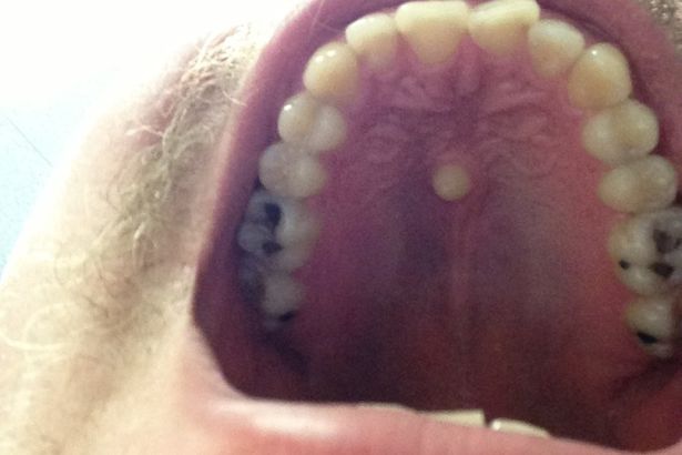 teeth teeth