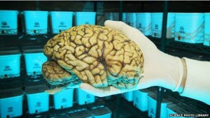 ९० वर्षको उमेरमा पनि मस्तिष्कको क्षमतामा सुधार आउन सक्ने
