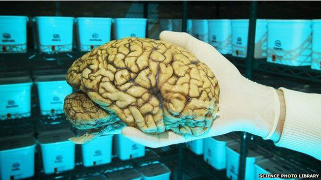 ९० वर्षको उमेरमा पनि मस्तिष्कको क्षमतामा सुधार आउन सक्ने