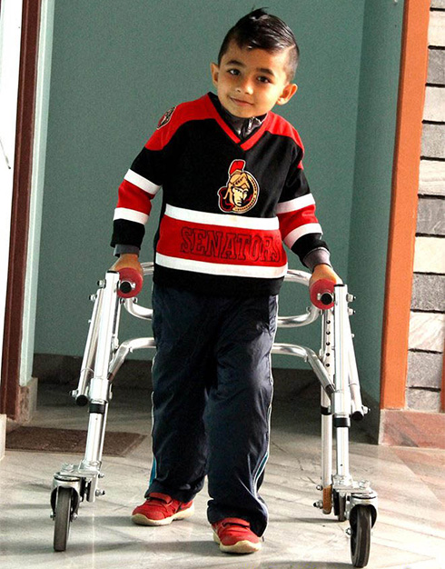 Animesh,-OsteogenesisImperfecta,-OI