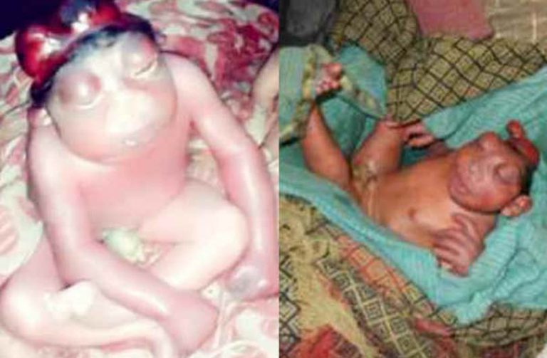 जन्मियो अनौठो बच्चा, जन्मिने बित्तिकै बस्न थाल्यो