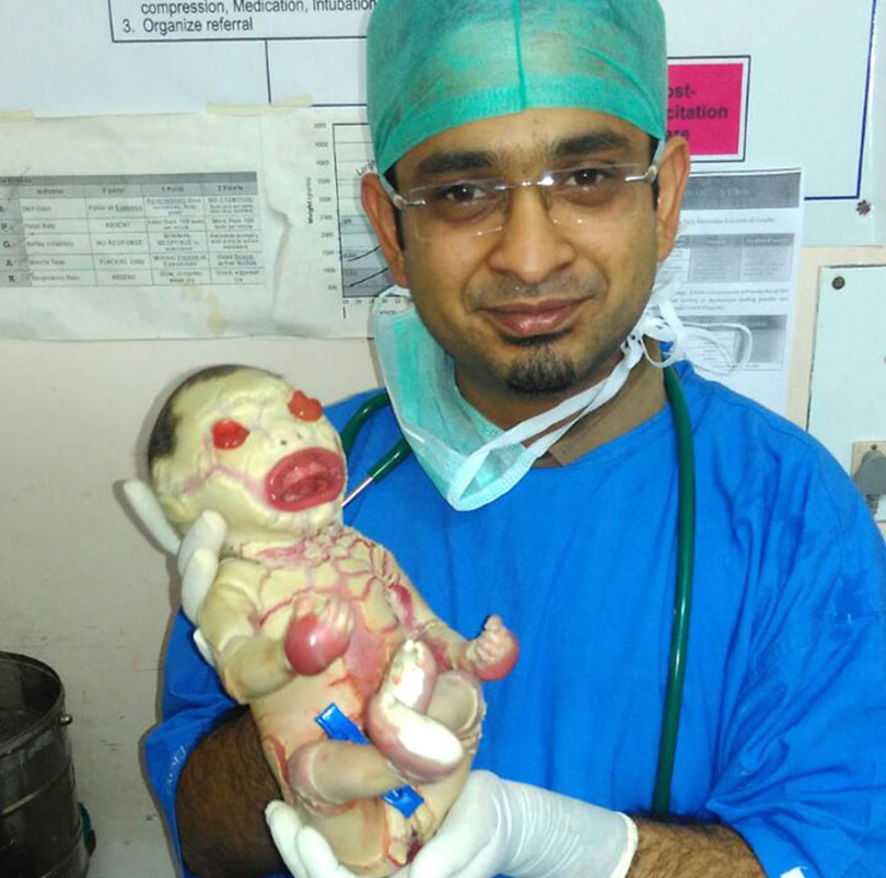Baby born with bizarre genetic disorder