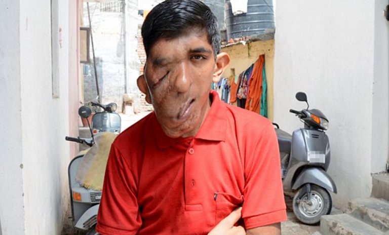 यी सोह्र वर्षे किशोरलाई देख्ने जो कोहीले जिब्रो टोक्छ