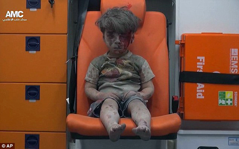 Young Syrian boy Omran Daqneesh, aged five, was injured during airstrikes in Aleppo, Photo AP