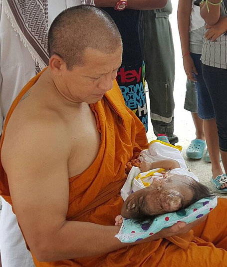 disabled-girl-is-cared-for-by-monks