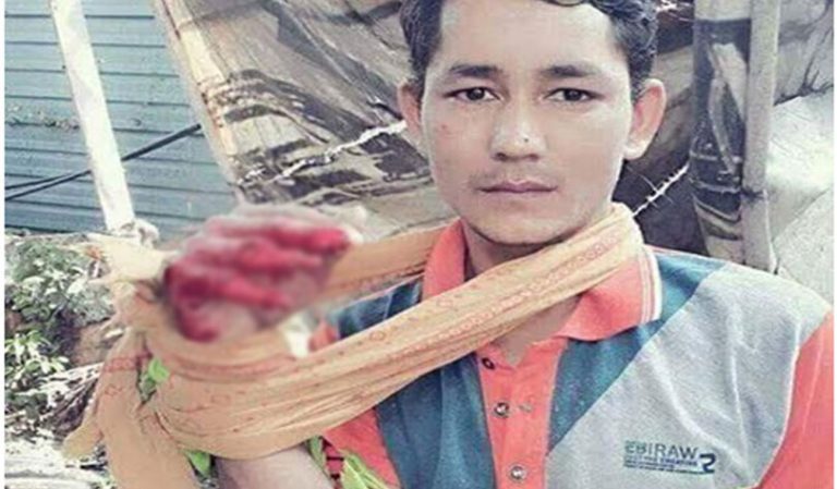 सपना बोकेर मलेसिया पुगेका भुपेन्द्र औंला गुमाएर फर्किए