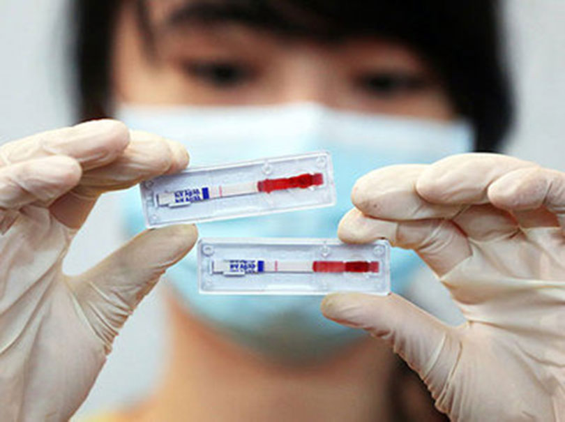 Экспресс тесты на инфекции. Тест на ВИЧ. Тестирование на ВИЧ инфекцию. Тест на ВИЧ И СПИД. Тест на ВИЧ картинки.