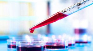 काभ्रेमा रगतको चरम अभाव, बिरामी समस्यामा