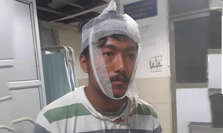 रामपुरमा एमाले र माओवादी विद्यार्थीबीच झडप
