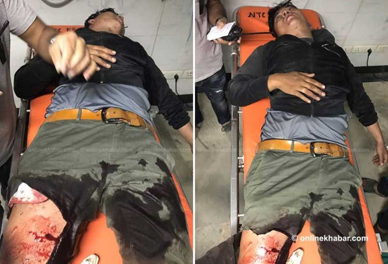मुलपानीमा प्रहरी र लुटेराबीच मुठभेड, नाइके खुँडे घाइते