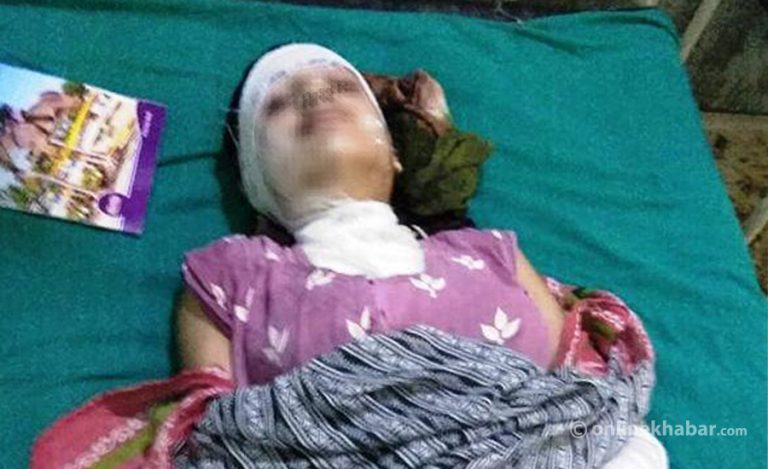 एसिड आक्रमणमा परेकी जेनी र मुस्कानलाई सरकारको ३ लाख सहयोग
