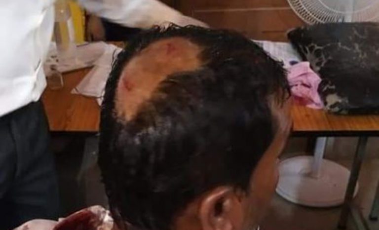 क्वारेन्टिन स्थलमा स्वास्थ्यकर्मी कुट्ने मुख्य आरोपी पक्राउ