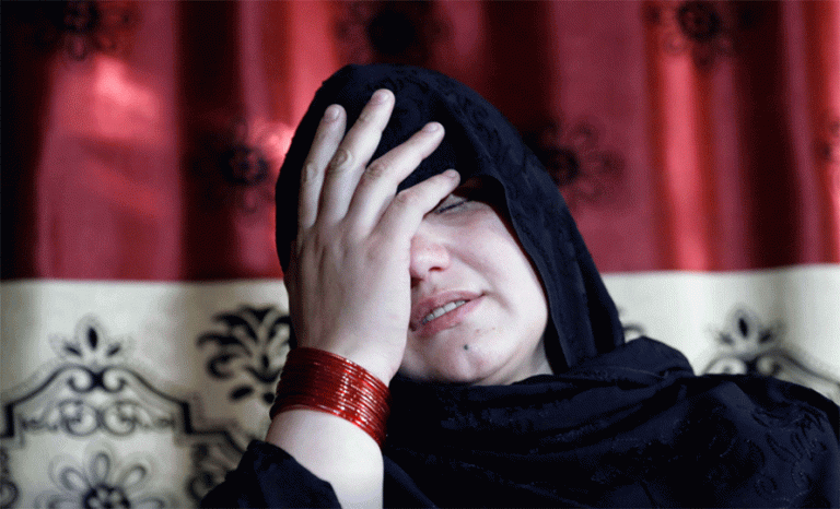 जागिर खाएकै कारण आँखा गुमाएकी यी अफगानी महिला
