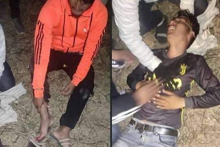 मध्यपश्चिमाञ्चल विश्वविद्यालयमा तनाव, प्रहरीद्वारा अश्रुग्यास प्रहार