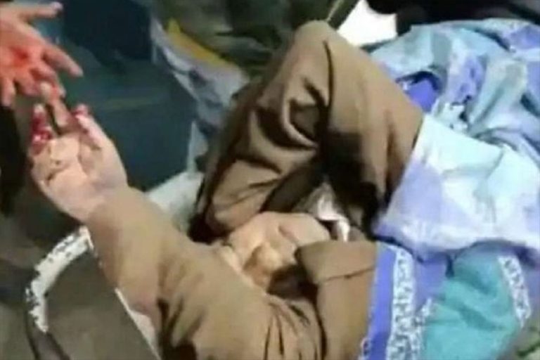 भारतमा मन्त्रीमाथि पेट्रोल बम प्रहार, अवस्था गम्भीर