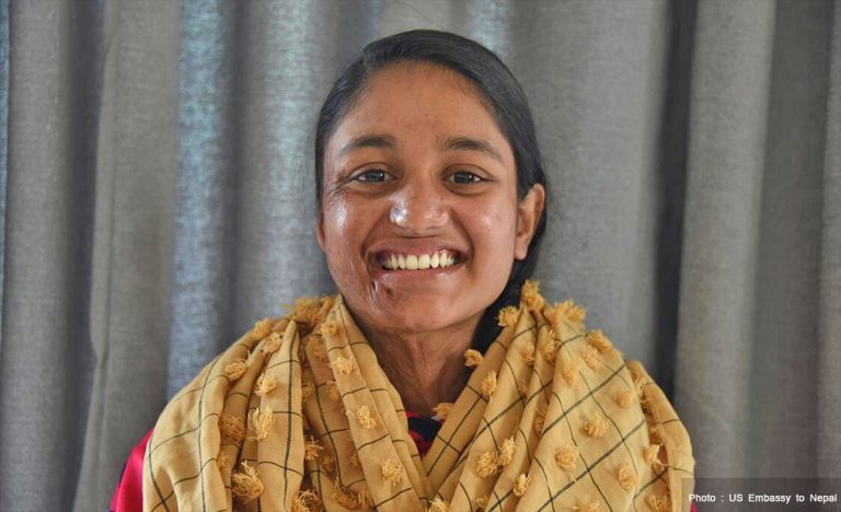 एसिडपीडित मुस्कान खातुनलाई प्रदेश-२ सरकारद्वारा पुनः ५ लाख सहयोग