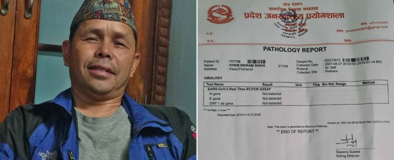 कोभिड वार्डको आईसीयूमा भेटिए जनमोर्चाका सांसद शाही
