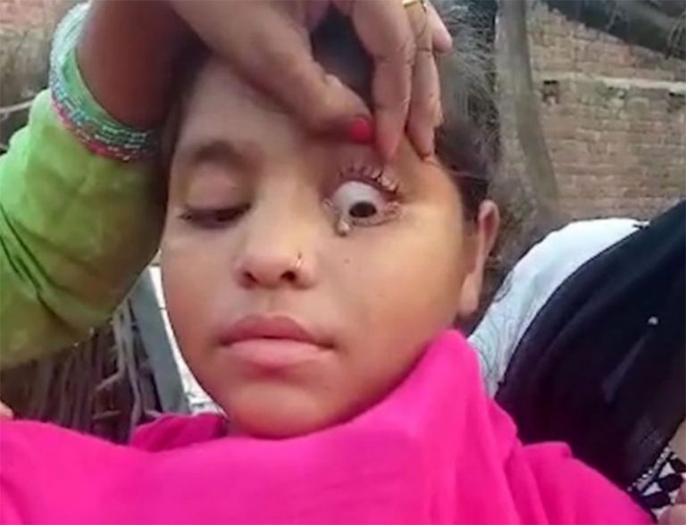 ढुंगाका आँशु झार्छिन् यी किशोरीले