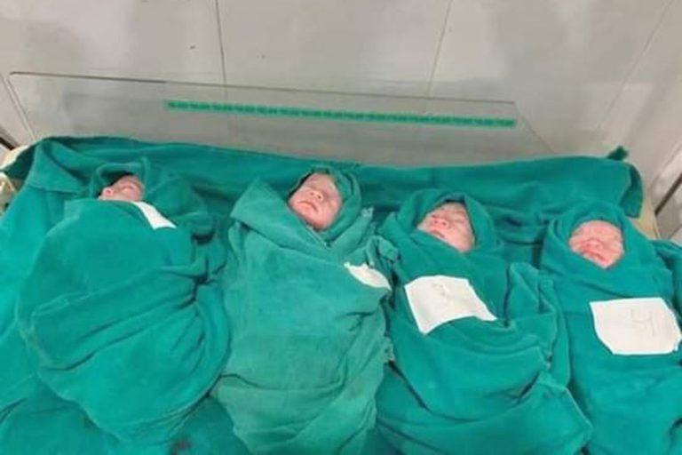 २४ वर्षीया महिलाले जन्माइन् चम्ल्याहा छोरी