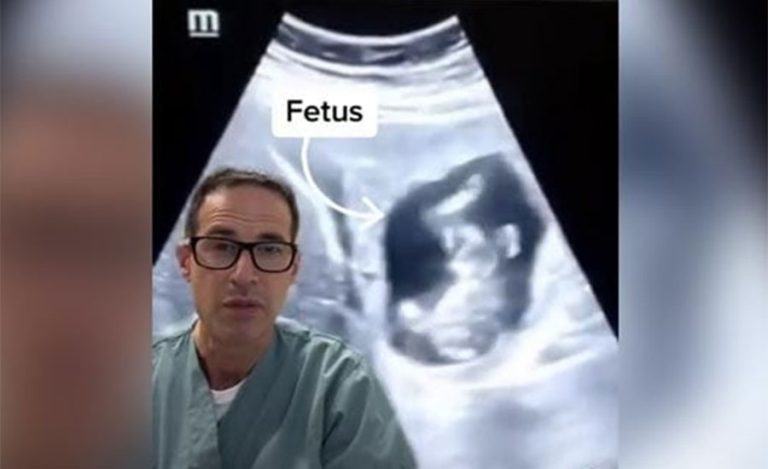 दुनियाँकै पहिलो घटना : महिलाको कलेजोमा बच्चाको भ्रूण !