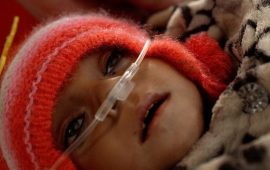 अफगानिस्तानका अस्पतालमा कुपोषणग्रस्त बालबालिकाको कारुणिक चीत्कार