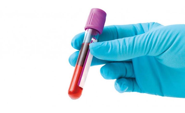 नसर्ने रोग पहिचान गर्न निःशुल्क रक्त परीक्षण कार्यक्रम