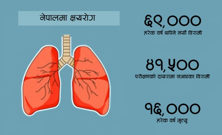 क्षयरोग नियन्त्रणमा नेपाल कहाँ चुक्यो ?