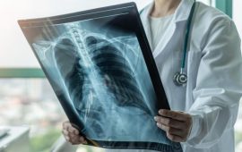 १४ वर्षमुनिका २७ जनामा क्षयरोग