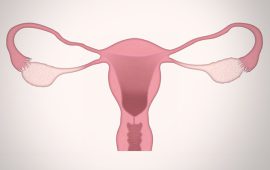 डिम्बाशयमा सिस्ट देखिएको छ ? क्यान्सर पनि हुन सक्छ