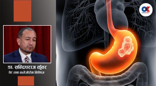 प्याङ्क्रियाटिक क्यान्सर कसरी हुन्छ ?