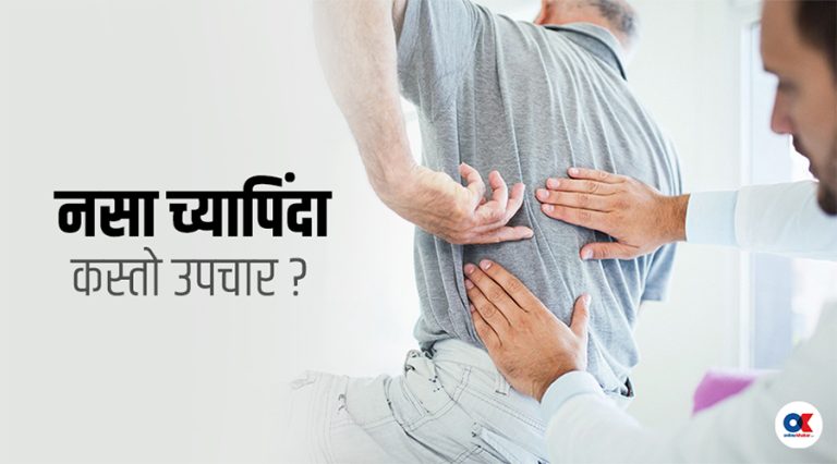 नसा च्यापिंदा शल्यक्रिया गर्ने कि फिजियोथेरापी ?