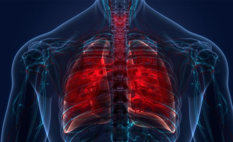 तनहुँमा आठ महिनामा १८३ क्षयरोगी उपचार गर्न आए