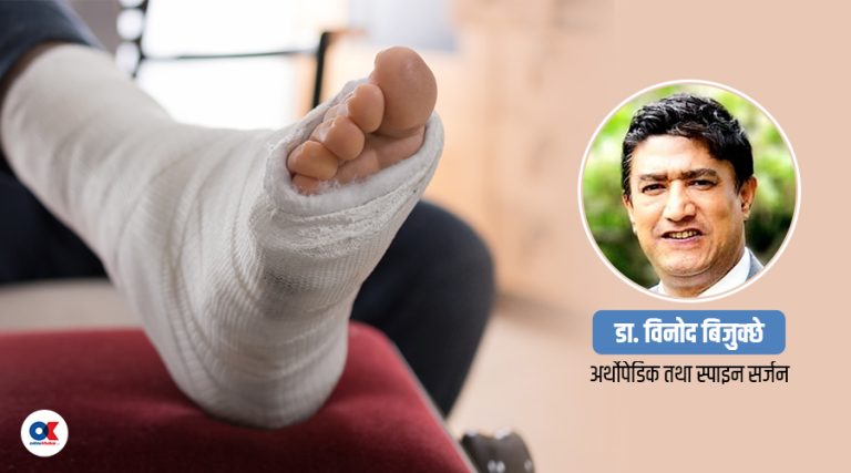 भाँचिएको हड्डी जोडिने प्रक्रिया के हुन्छ ?