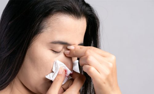 नाकबाट रगत बग्ने समस्यालाई हल्का लिनु हुँदैन