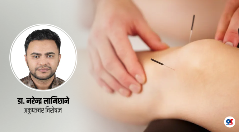 अकुपञ्चरलाई वैकल्पिक हैन, पूरक चिकित्साका रुपमा लिऔं