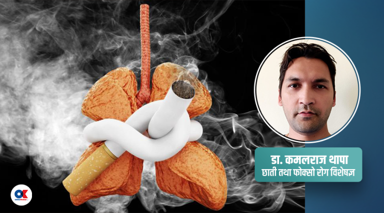 चुरोट छाडेपछि बिग्रिएको फोक्सो फेरि स्वस्थ हुन्छ ?