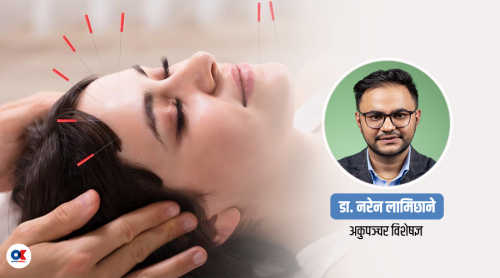 अकुपञ्चर चिकित्सा : १२ जिज्ञासा र जवाफ 