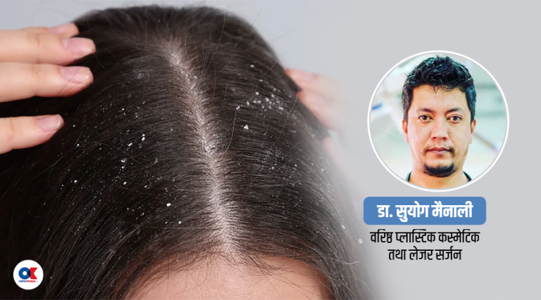जाडोमा चाया पर्ने समस्याबाट कसरी जोगिने ?