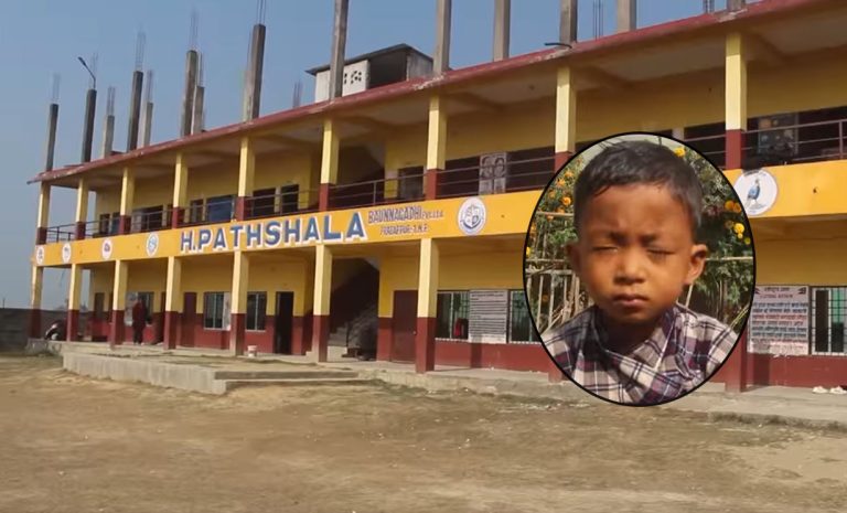 शिक्षिकाको कुटाइबाट यूकेजीमा पढ्ने विद्यार्थीको आँखा फुट्यो