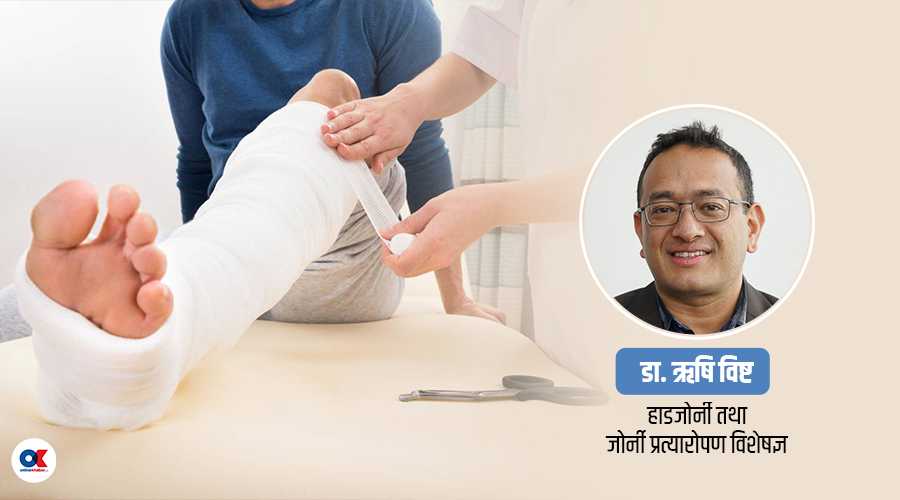 चुरोट खाने व्यक्तिको हड्डी भाँचिएमा जोडिन समस्या हुन्छ, किन ?