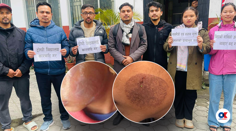 विद्यार्थीको गालामा तातो पन्युले डाम्ने शिक्षकलाई ५ दिन हिरासतमै राख्न अनुमति