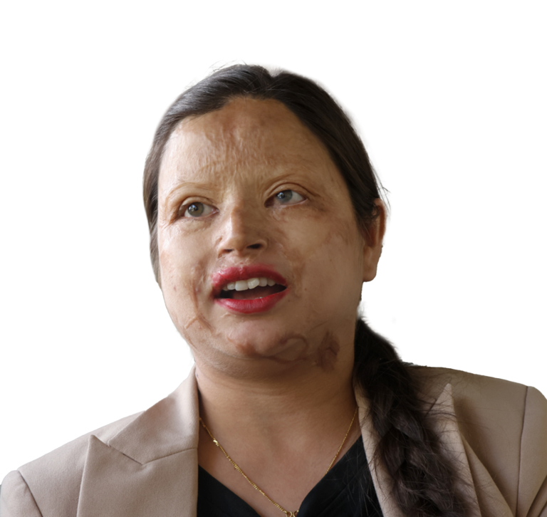 जलन पीडितकी जनप्रतिनिधि