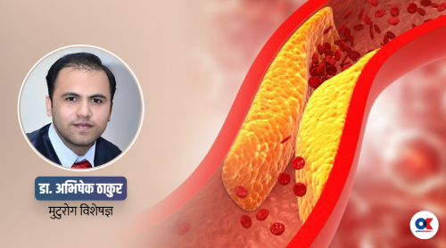कोलेस्टेरोल बढ्ने १० कारण, कसरी नियन्त्रणमा राख्ने ?