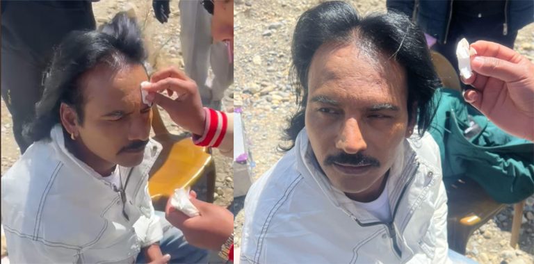 ‘जेरी अनटप’ फिल्म छायांकनका क्रममा माग्नेबुढा घाइते