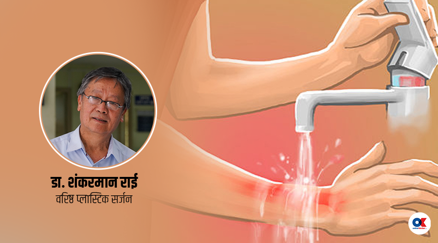आगोले पोल्नेबित्तिकै तुरुन्त के गर्ने ?