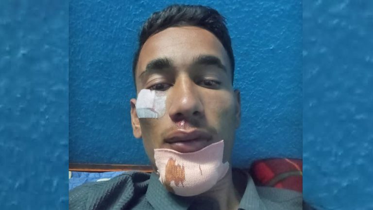 भक्तपुरको सानोठिमी क्याम्पसका स्ववियु अध्यक्षमाथि कुटपिट
