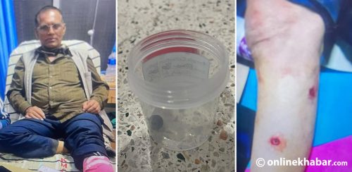 राजावादी आन्दोलनका घाइते : पाए आश्वासन, पाएनन् उपचार खर्च
